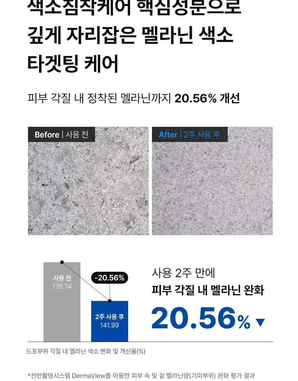 [멜라닌양개선] 동아제약 색소침착 프로 크림제 40ml 상세페이지 14